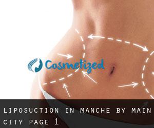 Liposuction in Manche by main city - page 1
