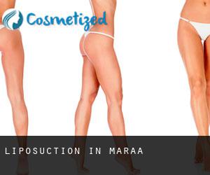 Liposuction in Maraã