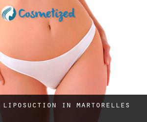 Liposuction in Martorelles