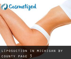 Liposuction in Michigan by County - page 3