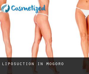 Liposuction in Mogoro