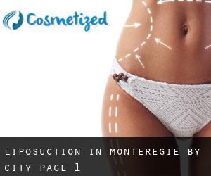 Liposuction in Montérégie by city - page 1