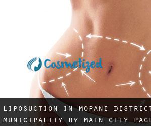 Liposuction in Mopani District Municipality by main city - page 1
