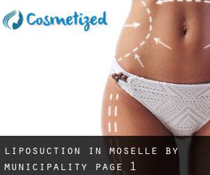 Liposuction in Moselle by municipality - page 1