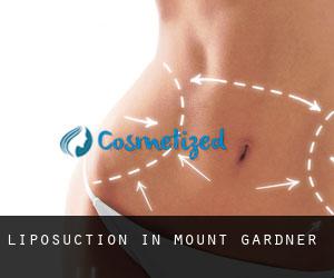 Liposuction in Mount Gardner