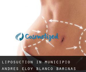 Liposuction in Municipio Andrés Eloy Blanco (Barinas)