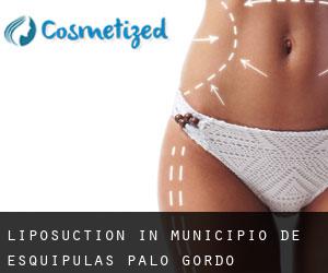 Liposuction in Municipio de Esquipulas Palo Gordo