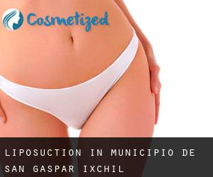 Liposuction in Municipio de San Gaspar Ixchil