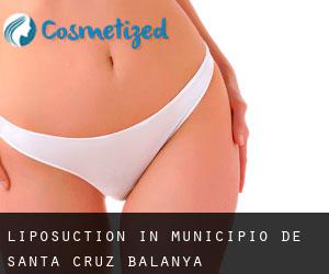 Liposuction in Municipio de Santa Cruz Balanyá