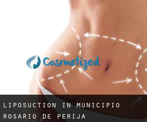 Liposuction in Municipio Rosario de Perijá