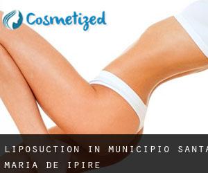 Liposuction in Municipio Santa María de Ipire