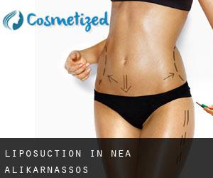 Liposuction in Néa Alikarnassós