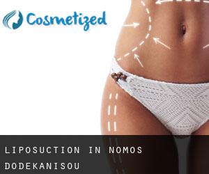 Liposuction in Nomós Dodekanísou