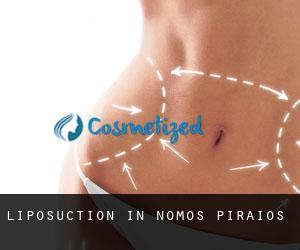 Liposuction in Nomós Piraiós