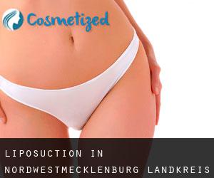 Liposuction in Nordwestmecklenburg Landkreis