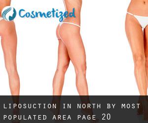 Liposuction in North by most populated area - page 20