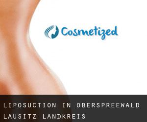 Liposuction in Oberspreewald-Lausitz Landkreis