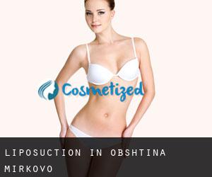 Liposuction in Obshtina Mirkovo