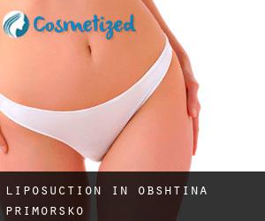 Liposuction in Obshtina Primorsko