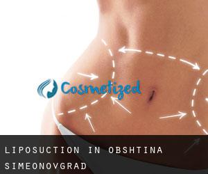 Liposuction in Obshtina Simeonovgrad