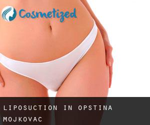 Liposuction in Opština Mojkovac