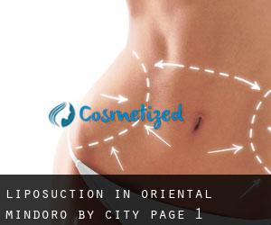 Liposuction in Oriental Mindoro by city - page 1