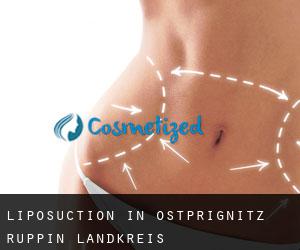 Liposuction in Ostprignitz-Ruppin Landkreis