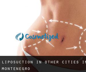Liposuction in Other Cities in Montenegro