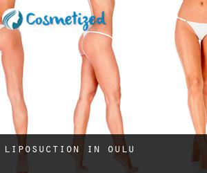 Liposuction in Oulu
