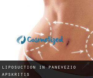 Liposuction in Panevėžio Apskritis