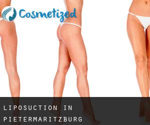 Liposuction in Pietermaritzburg