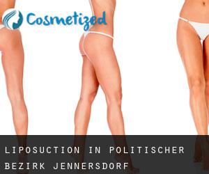 Liposuction in Politischer Bezirk Jennersdorf
