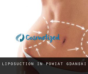 Liposuction in Powiat gdański