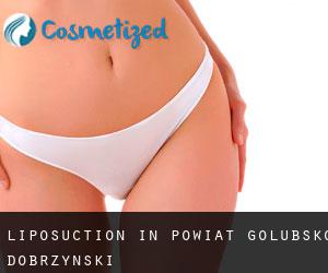 Liposuction in Powiat golubsko-dobrzyński