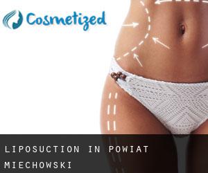 Liposuction in Powiat miechowski