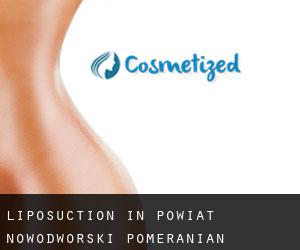 Liposuction in Powiat nowodworski (Pomeranian Voivodeship)