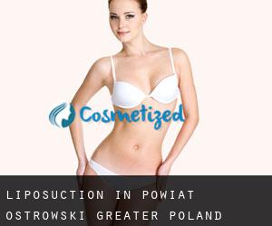 Liposuction in Powiat ostrowski (Greater Poland Voivodeship)