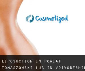 Liposuction in Powiat tomaszowski (Lublin Voivodeship)