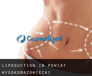 Liposuction in Powiat wysokomazowiecki