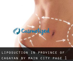 Liposuction in Province of Cagayan by main city - page 1
