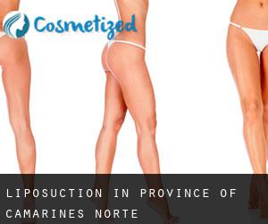 Liposuction in Province of Camarines Norte