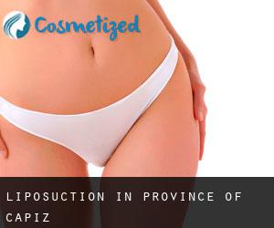 Liposuction in Province of Capiz