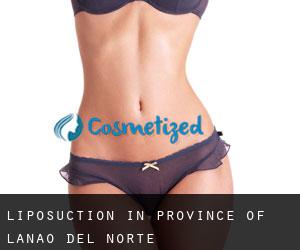 Liposuction in Province of Lanao del Norte