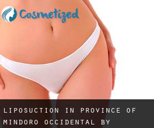 Liposuction in Province of Mindoro Occidental by municipality - page 1