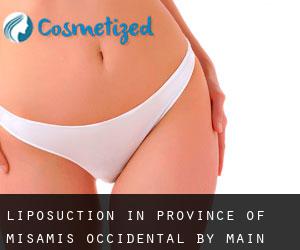 Liposuction in Province of Misamis Occidental by main city - page 1
