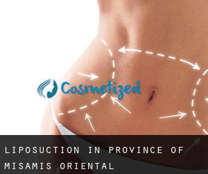 Liposuction in Province of Misamis Oriental