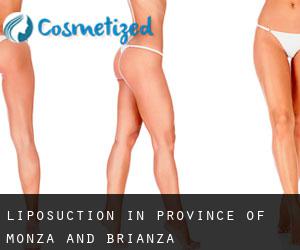 Liposuction in Province of Monza and Brianza
