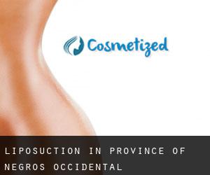 Liposuction in Province of Negros Occidental