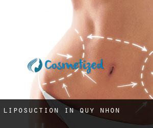 Liposuction in Quy Nhơn