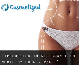 Liposuction in Rio Grande do Norte by County - page 1